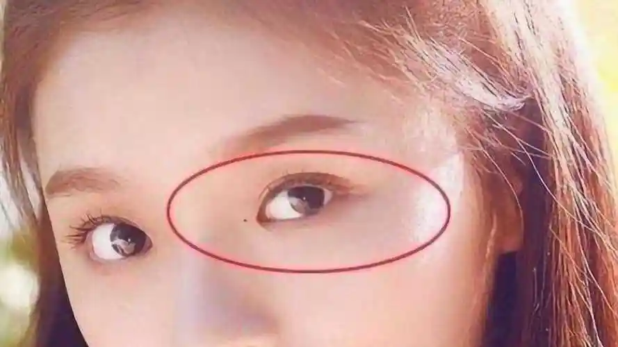 眼角有痣的人特别单纯,一不小心就被骗!