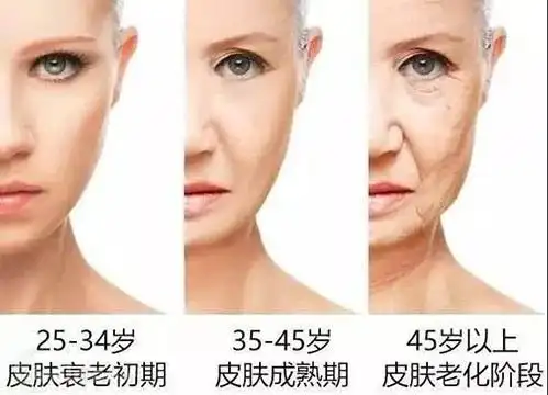 女人的衰老分等级 越早预防越好
