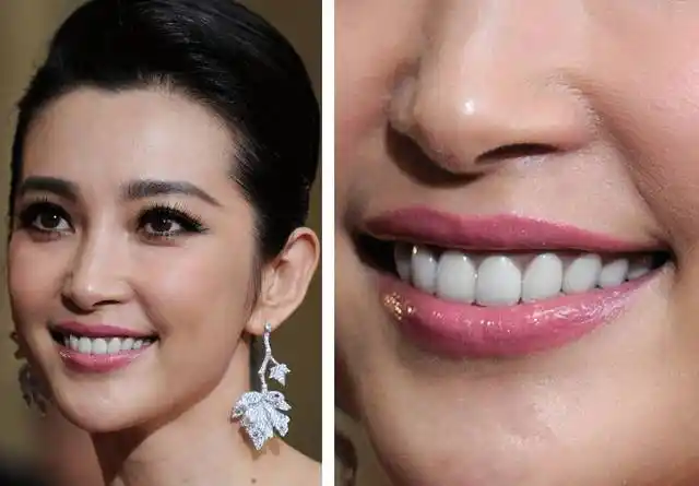 翻遍老资料和老图片,推测巩俐的烤瓷牙大约是90年代中后期做的(左)