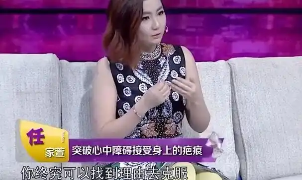 她19岁爆红,意外毁容被前夫嫌"想吐",现与小7岁男友未婚生子