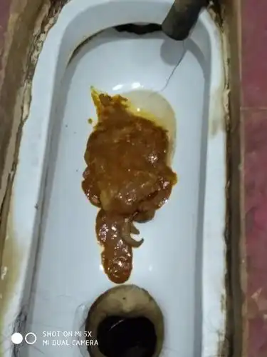 大便异常,肠胃不舒服