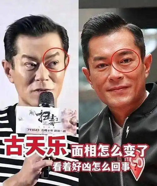 53岁古天乐近照遭吐槽凶神恶煞,被质疑打针拉皮过度导致医美失败_网友