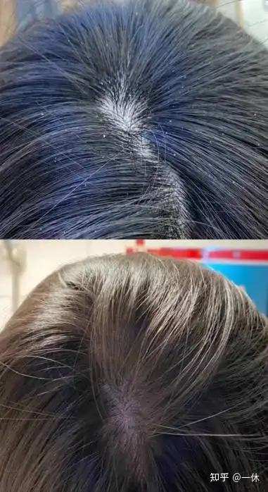 油性头皮和油性皮肤适合用的洗护产品——良心推荐!