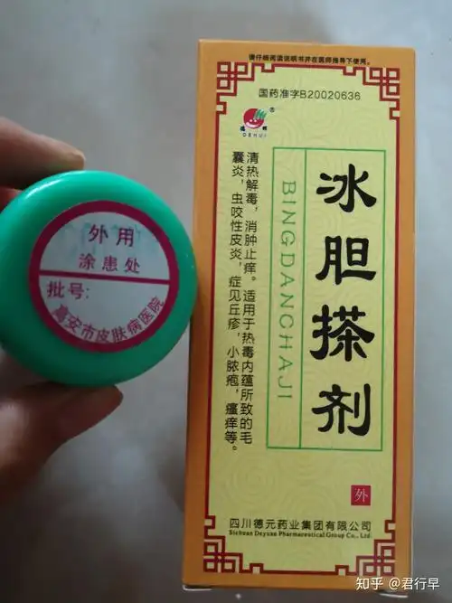 丘疹性荨麻疹像蚊子叮的全身长剧烈瘙痒一个星期后会变黑