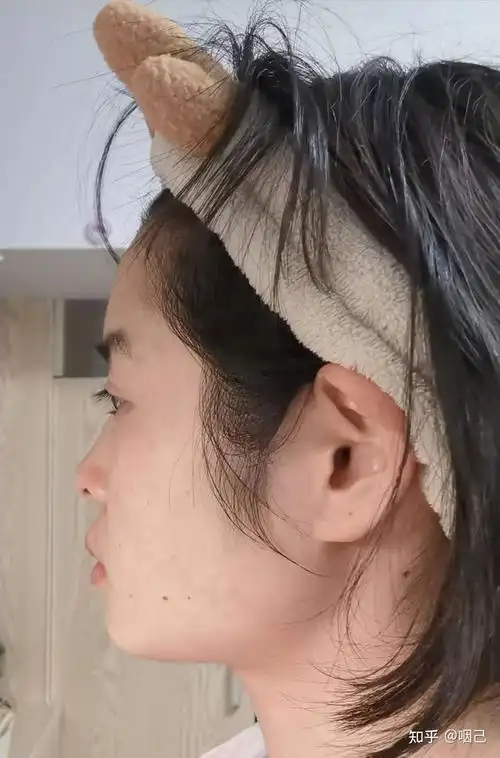 侧脸丑而正脸好看是一种什么体验?