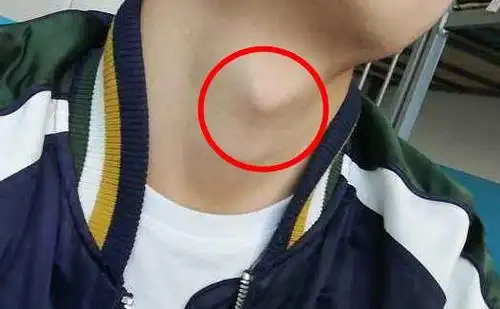 亲男生喉结有啥反应男生喉结有什么作用