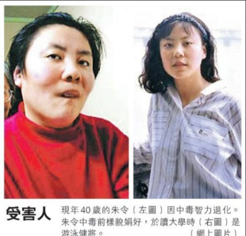 清华学霸因"铊中毒",智商停在七岁,本应惋惜评论区却怨声一片