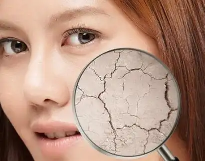 干燥性皮肤必看-防止干燥性皮肤的水分流失!