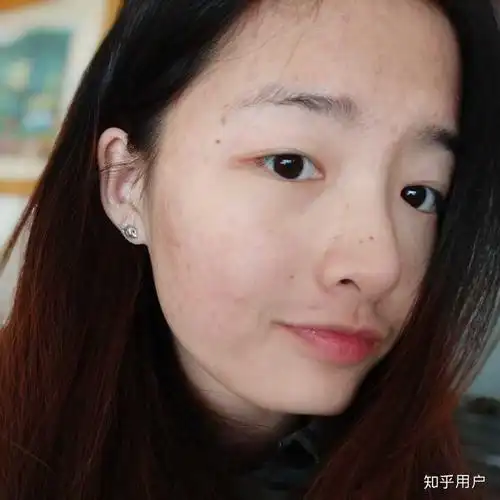 怎么看待五官漂亮但是皮肤差的女性?