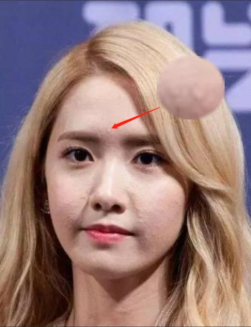 但比痘痘还要烦人,就连公认的美人刘诗诗和允儿也难逃闭口的"魔咒"