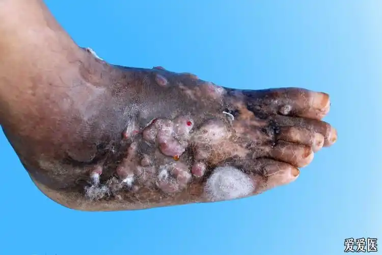 疑难皮肤病诊断图