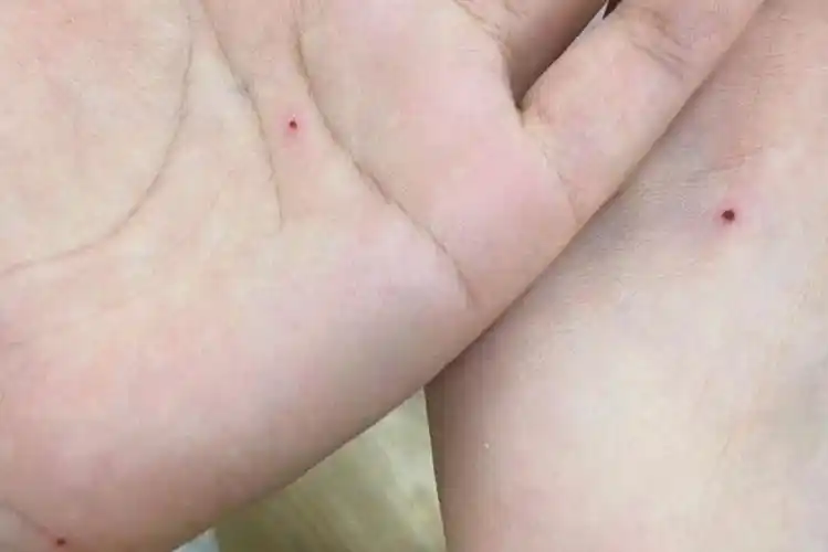 朱砂痣的象征和寓意有趣的说法