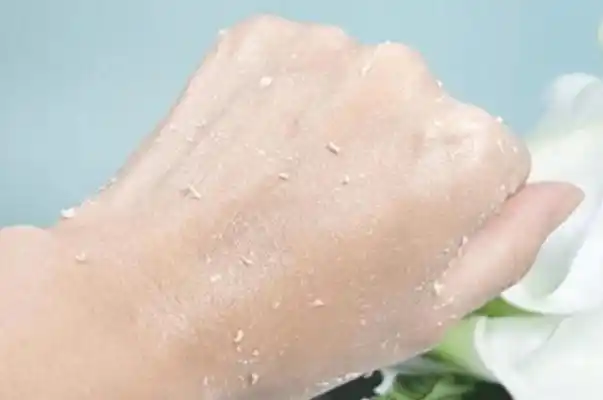 去角质的产品哪款好用去角质对痘痘有用吗