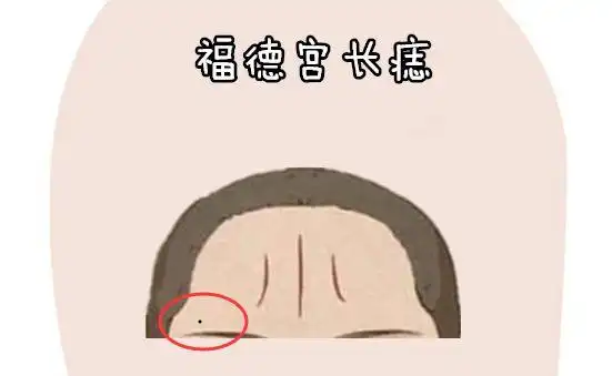 身上4颗"穷"痣,前半生苦,后半生累,手里没钱,晚年没人管!_网易订阅