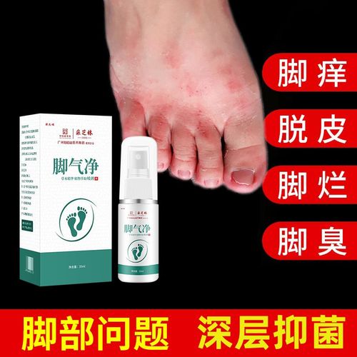 复方芙联脚臭脚痒苯苄唑溶笇唑喷雾烂脚脱皮止痒抑菌脚痒脚臭