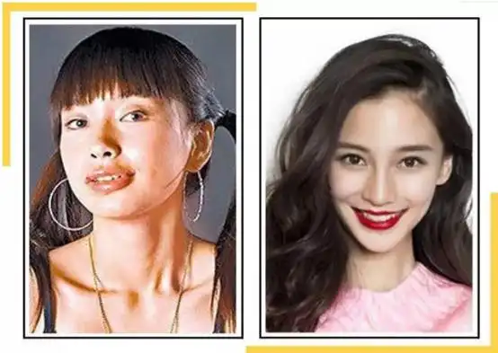 杨颖整容前(杨颖出道前"丑照"曝光,遭质疑整容,回应:当时确实很丑)