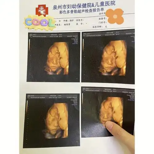 孕期日记23w6三级四维一次通过06