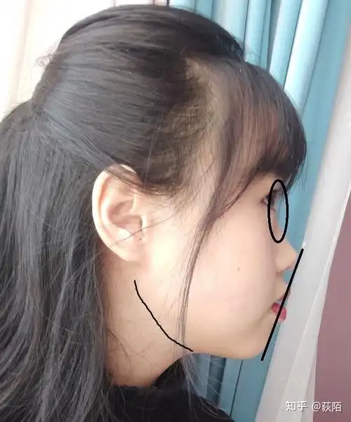 为什么我侧脸这么丑是因为鼻子还是因为就是鼻子以下的部位有问题