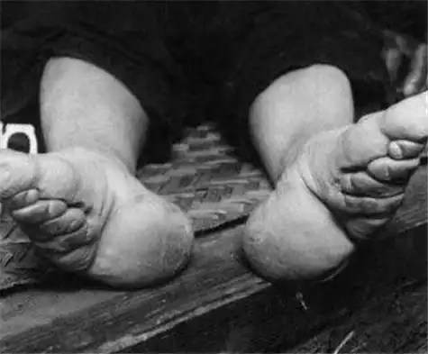 她16岁因三寸金莲嫁入大户裹着脚从不洗90年来仅丈夫见过