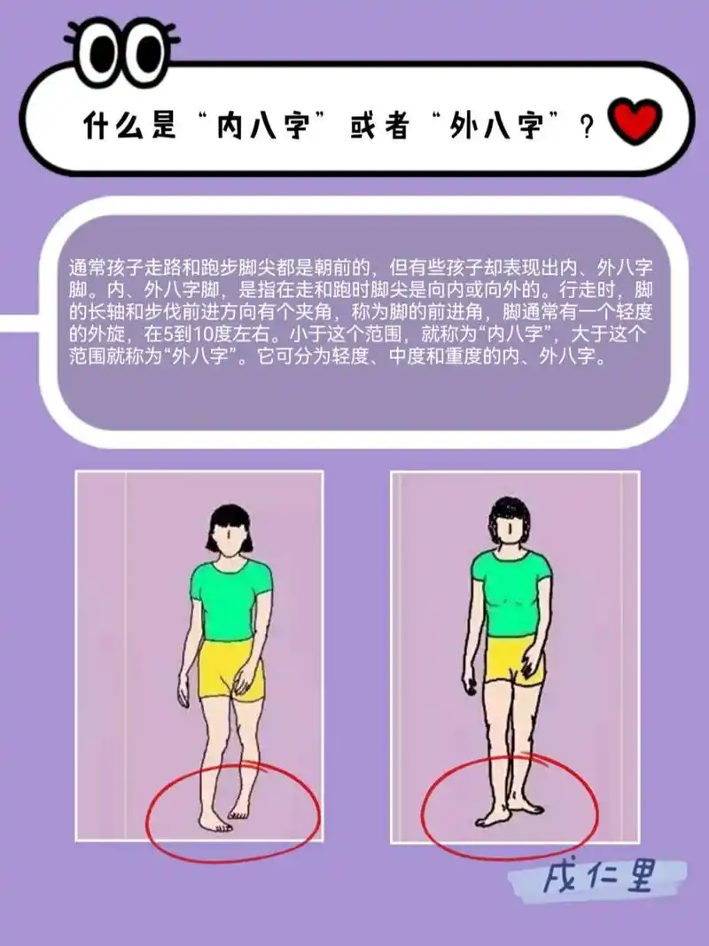 家庭教育经验分享 #内八字脚 #外八字脚 94观察一下宝宝走路08