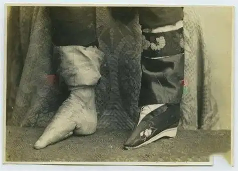 裹脚是什么时候有的(裹脚是什么时候有的多少年了)_大全-幸福起航