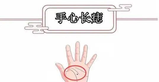 千金难买5颗痣颗颗带财男人升官不愁女人发财不愁