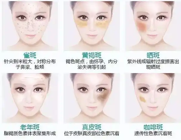 如何区分斑的类别?