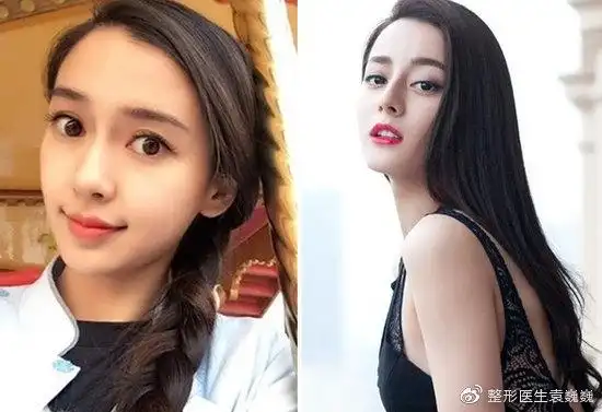 为什么迪丽热巴没有成为新的整形模板?