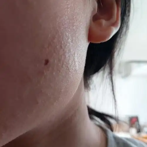 皮肤超级干起皮发红还痒姐妹们救救我?