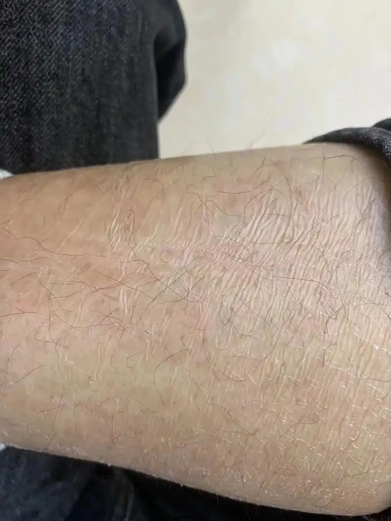 鱼鳞皮肤洗澡日常