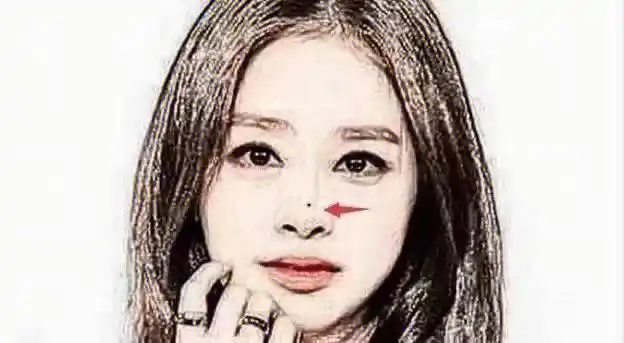 点痣  都说鼻子是破财痣,真的有越来越好了呢