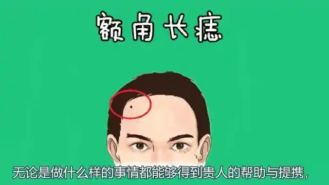 身体5颗靠山痣日后必定飞黄腾达成为大富大贵之人