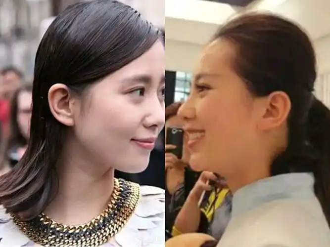 94后脑勺扁平的女明星有谁?