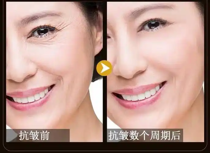 抗皱护肤品排行榜前十名让您拥有年轻肌肤