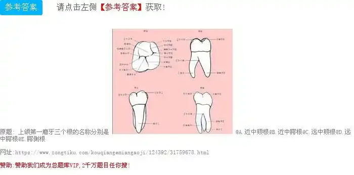 上颌第一磨牙三个根的名称分别是