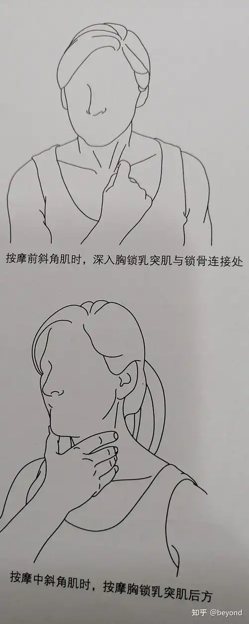 按摩后斜角肌的方法,用中指推压斜方肌前缘与锁骨连接处,向下施加压力