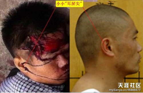 被枪爆头是怎样一种体验?