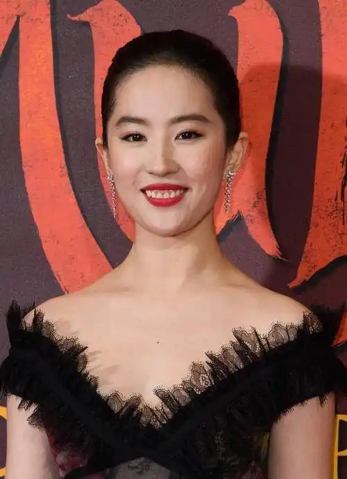 刘亦菲的牙齿属于前牙龈低,笑起来暴露过多牙龈,就显得十分不美观