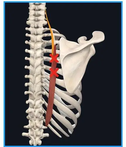 肩胛骨内侧痛始终缓解不了怎么办