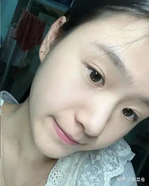 女生如何养好皮肤?