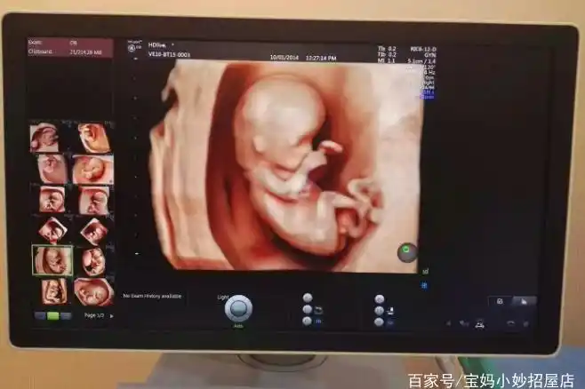 b超单上3个数据,或许暗示胎儿性别"秘密",看不懂的孕妈好可惜