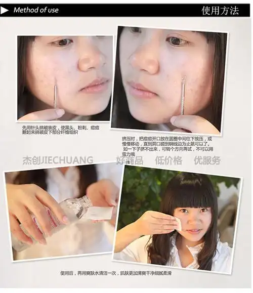 粉刺针暗疮针弯头双头11cm抗菌黑头痘痘