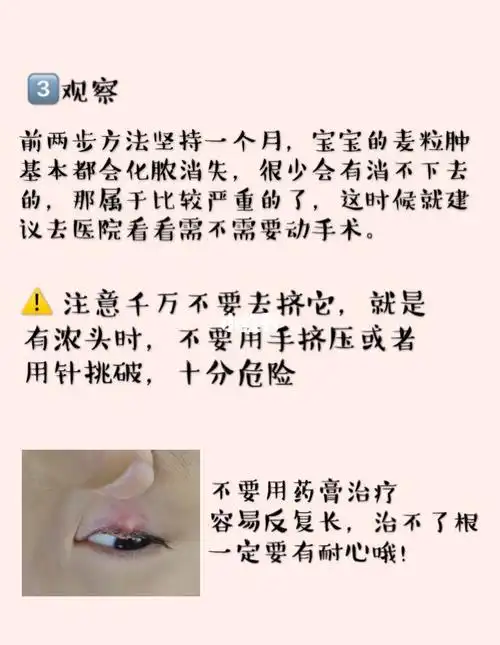 宝宝长了霰粒肿/麦粒肿?
