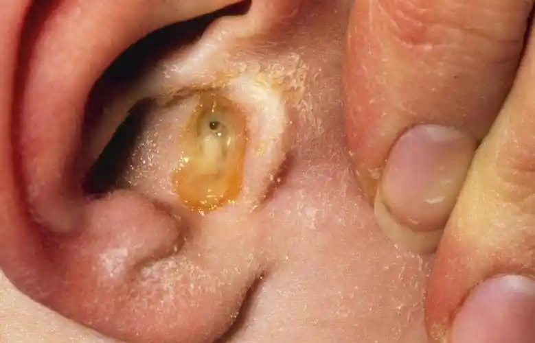 医生提醒:耳朵里面经常痒,或是这3种病的表现,最好上点心