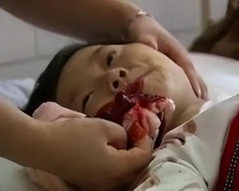 青海小苏丽:3岁被针线缝嘴5岁被虐死,母亲出狱后将其挫骨扬灰