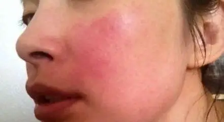 敏感肌的小可爱看过来,你该这么办?