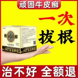 牛皮癣藓银屑病皮肤癣手足股头皮癣治疗湿疹止痒去根专用特效药膏