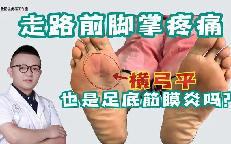 足底筋膜炎走路脚掌疼痛,前脚掌横弓平也是足底筋膜炎吗?