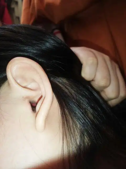 耳朵里面红红是怎么了吗