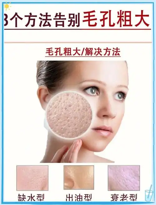 毛孔粗大怎么办3个方法收缩毛孔护肤